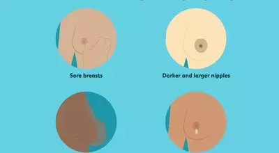 Understanding Breast Transformations During Pregnancy: A Comprehensive Guide