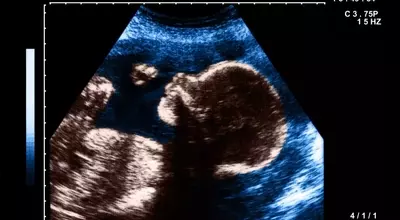 The Art and Impact of Pregnancy Nicknames