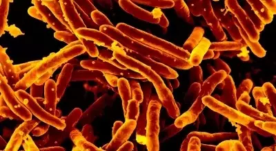Revolutionizing Tuberculosis Diagnostics: A New Era of Swift and Accurate Detection