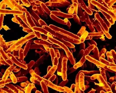 Revolutionizing Tuberculosis Diagnostics: A New Era of Swift and Accurate Detection