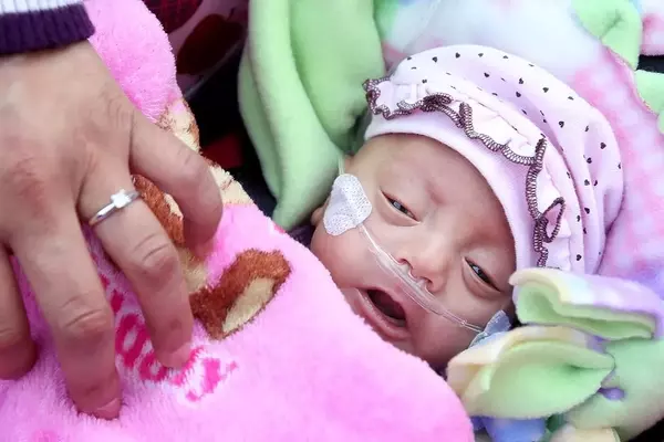 The Amazing Resilience of Premature Babies: Stories of Survival and Hope