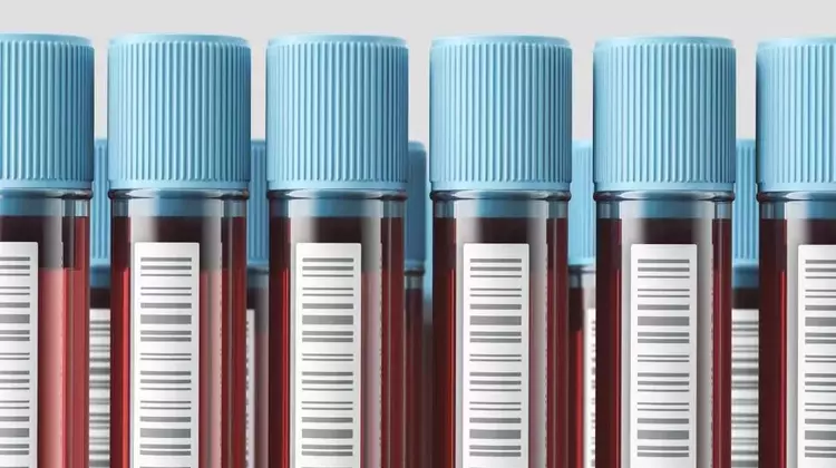 Direct-to-Consumer Blood Testing: Empowerment or Peril?